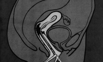 Abortvejledning Abortvejledning