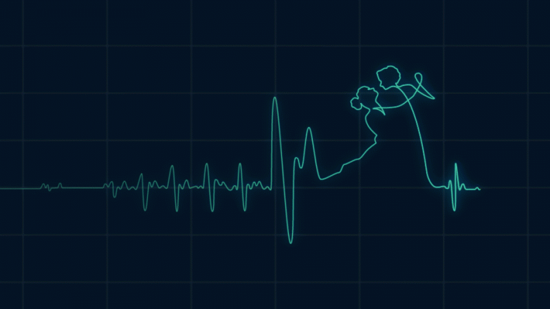  ElectroCardioDance animation