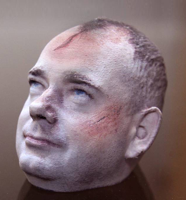 A 3D printed model created by Evidential to show cranial injuries