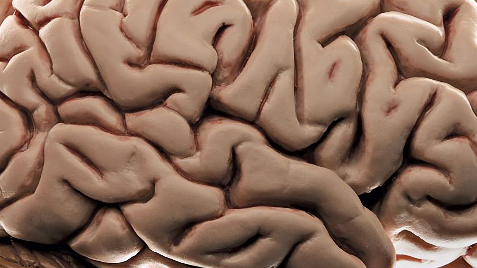 brain1