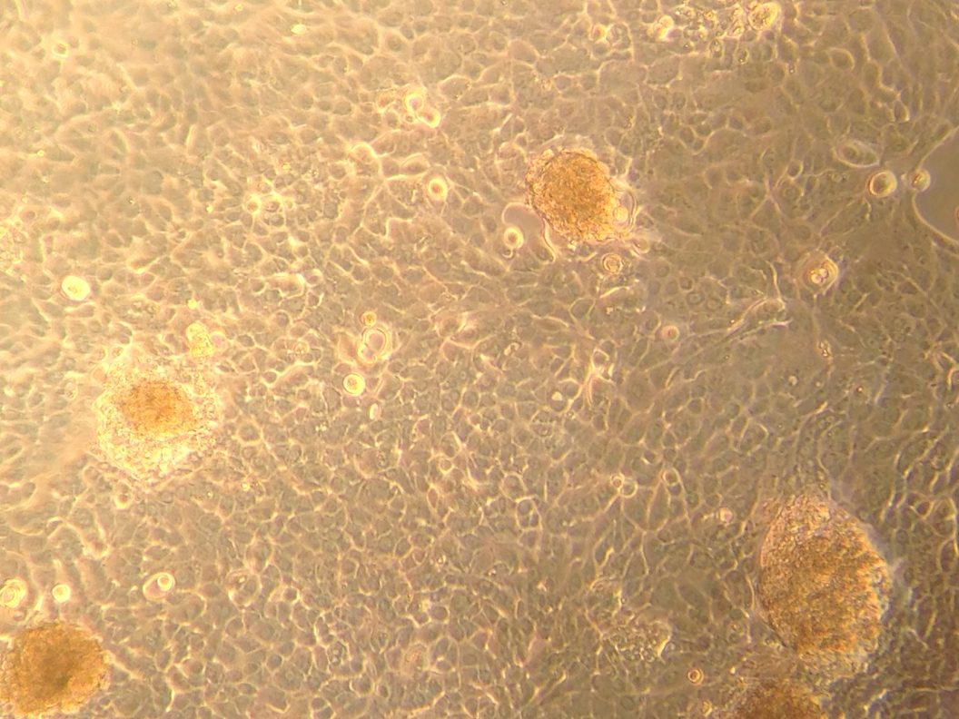 Celmateriaal-voor-de-kunstmatige-alvleesklier-gekweekt-in-het-lab.-Fotocredits-E.-Berishvili.-