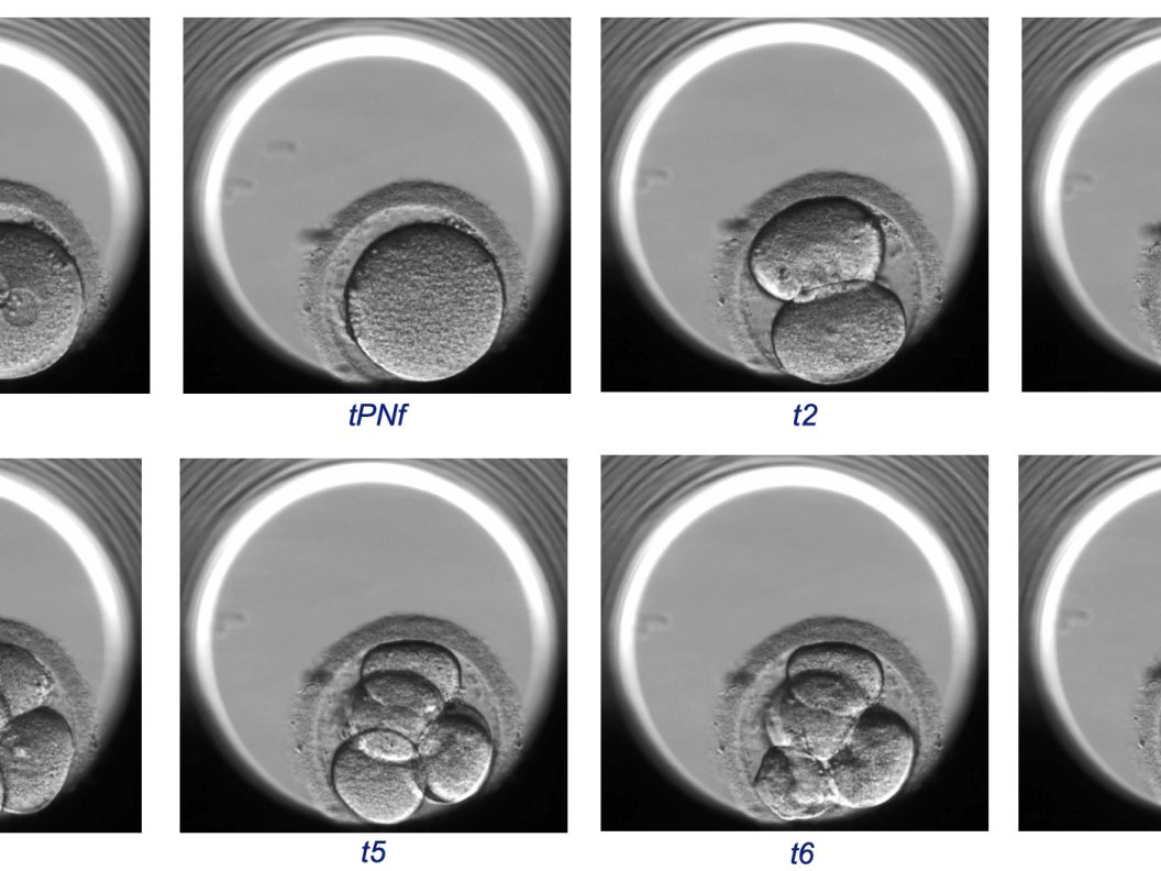 embryo