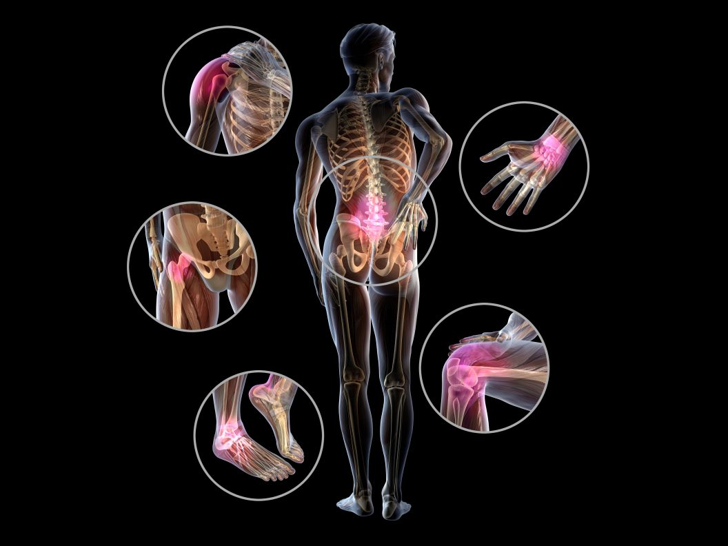 3d,Illustration,Showing,Painful,Joints,Of,A,Man,,Rheumatoid,Arthritis