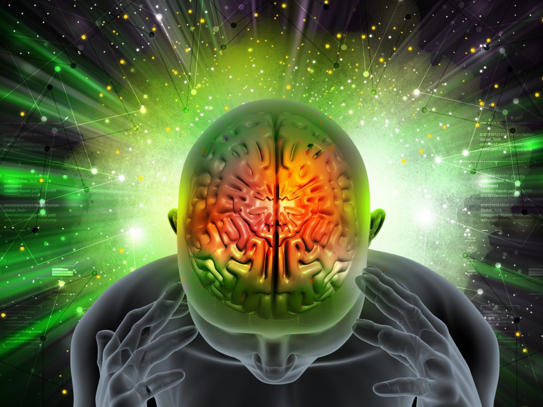 artist impression migraine