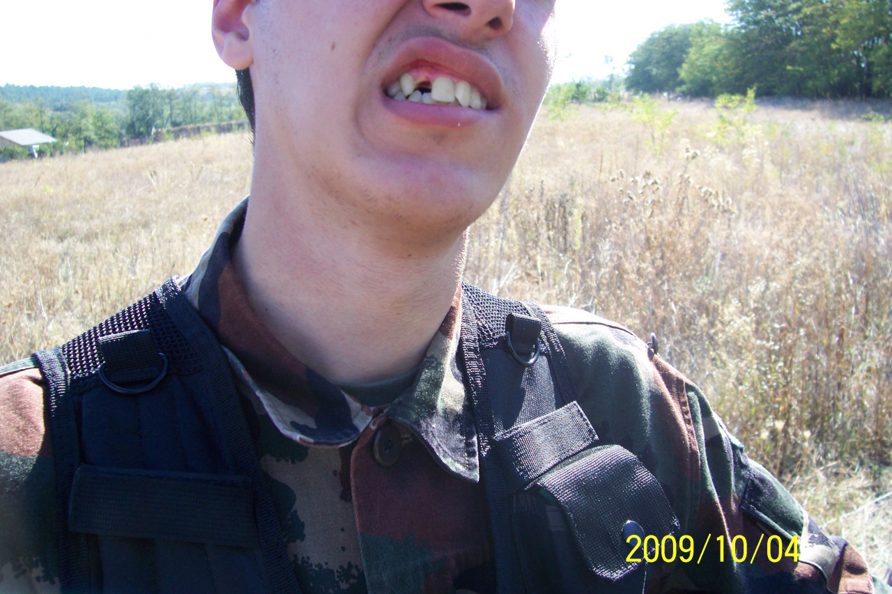 Névtelen 22-04-14 - Ezért kell a védőmaszk CQB esetén!!!