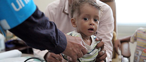 A boy is screened for malnutrition in Sa’ada, Yemen, Thursday