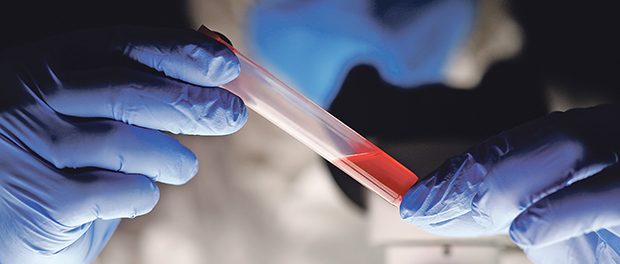 Male chemist examining blood sample in dark laboratory