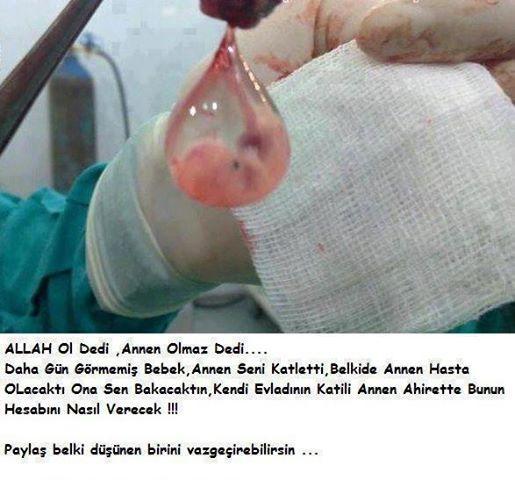 Sperm ve kadin yumurtasi nasil bir cocuga dönusüyor dusundunuz mu?