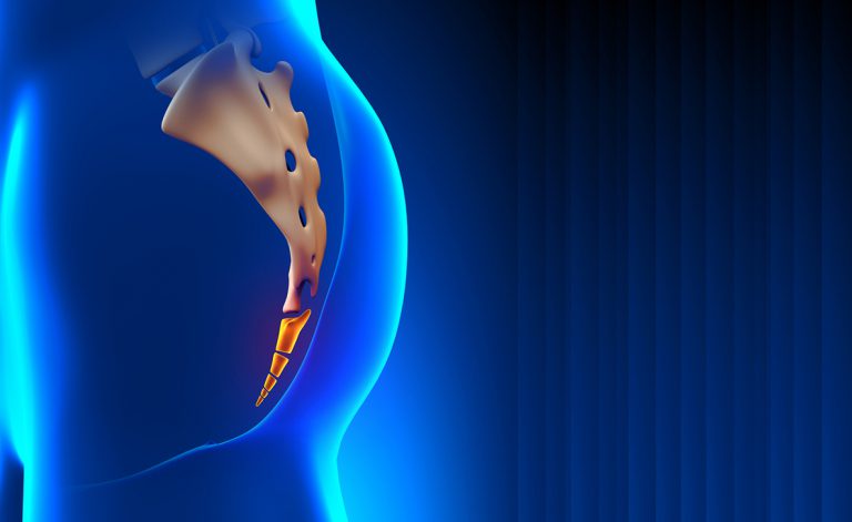 Cisti sacrococcigea: di che si tratta? | Pazienti.it