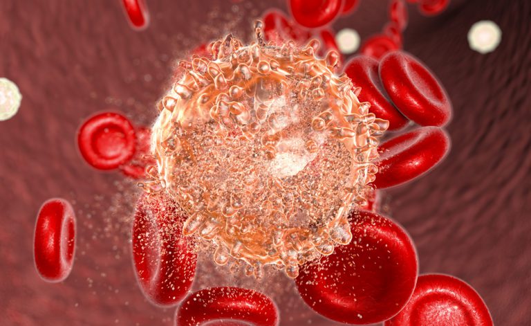 Leucemia mieloide cronica (LMC): l’efficacia dei nuovi trattamenti | Pazienti.it