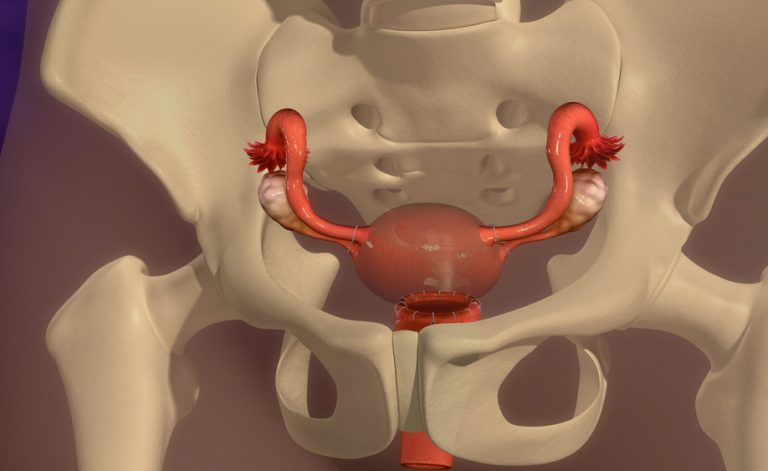 Isterectomia: un fattore di rischio per malattie cardiache, cancro e morte prematura? | Pazienti.it