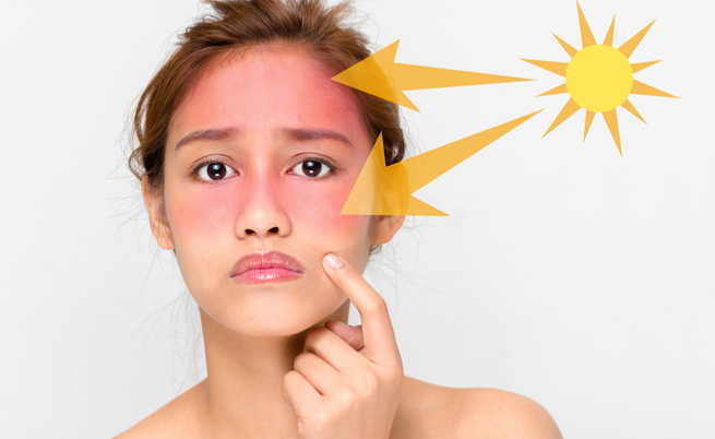 Scottature? Come eliminare quell’antiestetico rossore | Pazienti.it