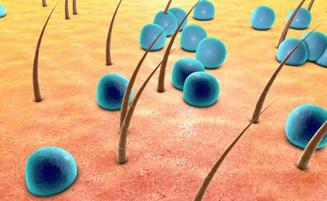 Impetigine: come si trasmette questa infezione della pelle? Ecco i fattori di rischio | Pazienti.it