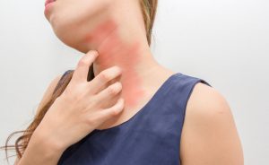 Il sudore irrita la pelle? In aiuto arriva l’amido di riso