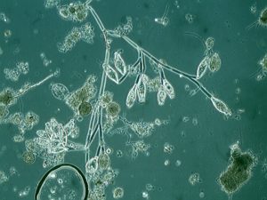 Immagine al microscopio di batteri dei fanghi attivi