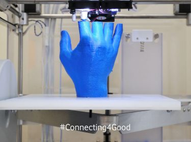 Handprothese-aus-dem-3D-Drucker