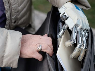 Bionische Handprothese