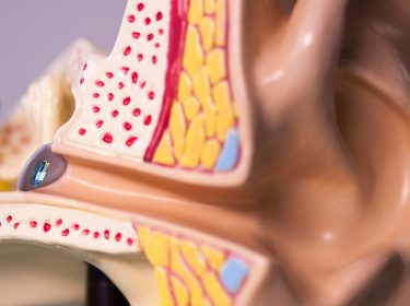 Die Kontaktlinse für die Ohren liegt direkt auf dem Trommelfell auf